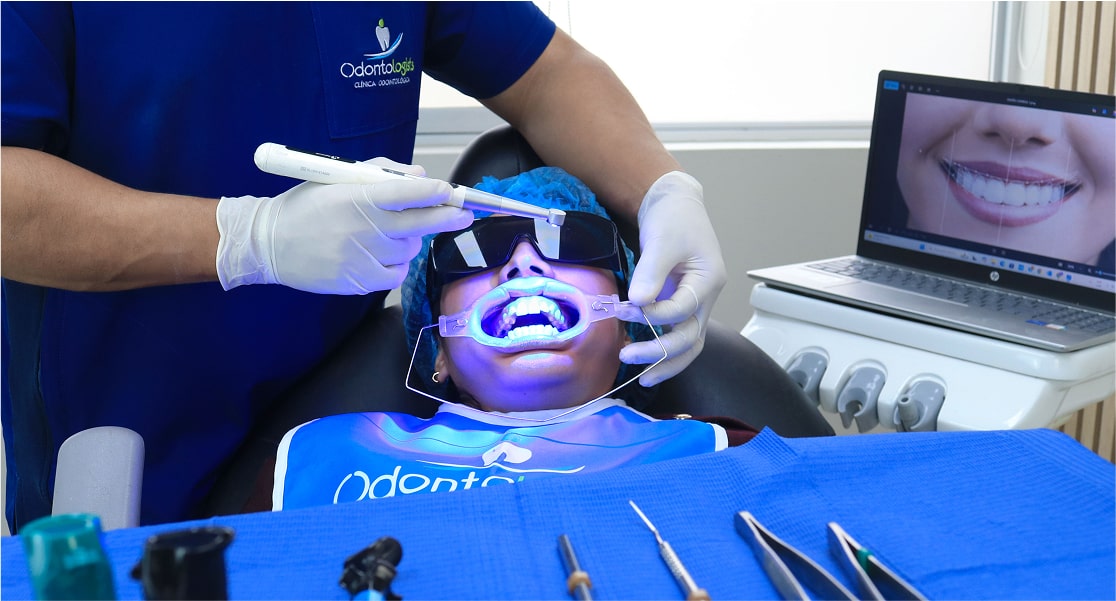 Inicio 15 BLANQUEAMIENTO DENTAL min
